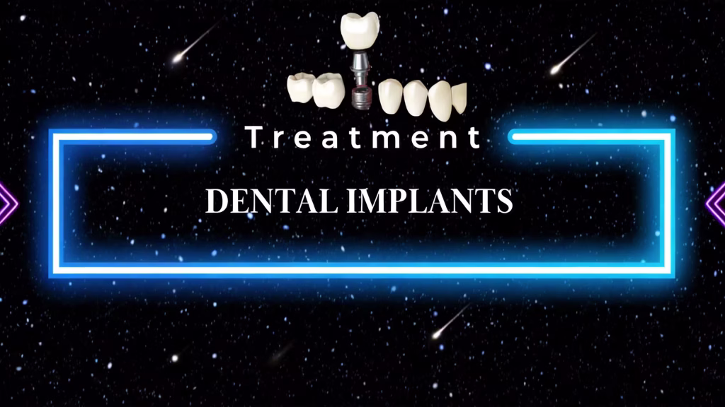 Reclaim Your Smile: Exploring Affordable Dental Implants Abroad 1 Affordable Dental Implants Abroad