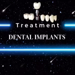 Reclaim Your Smile: Exploring Affordable Dental Implants Abroad