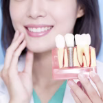 Reshaping Smiles in China with World-Class Full Mouth Implants: Quality and Cost-Effectiveness