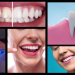 Unlock Your Brightest Smile: Teeth Whitening Abroad