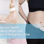 Reboot Your Health: A Guide to Weight Loss Surgery in Guangzhou, China