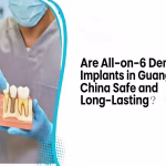 Are All-on-6 Dental Implants in Guangzhou, China Safe and Long-Lasting?