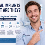 What Are Dental Implants? A Complete Beginner’s Guide from Scratch