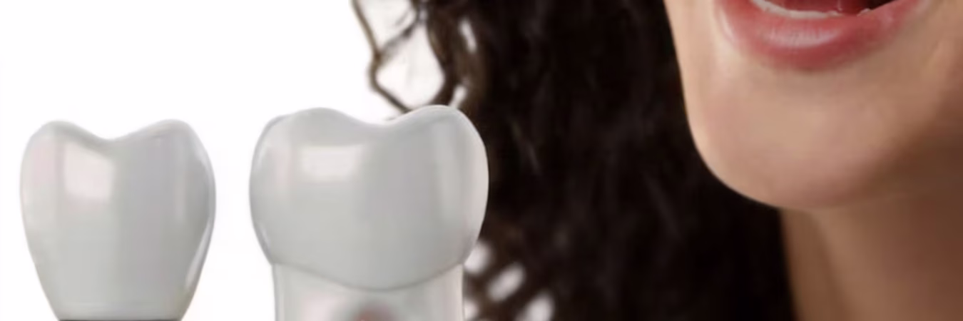 Full Arch Dental Implants Guangzhou