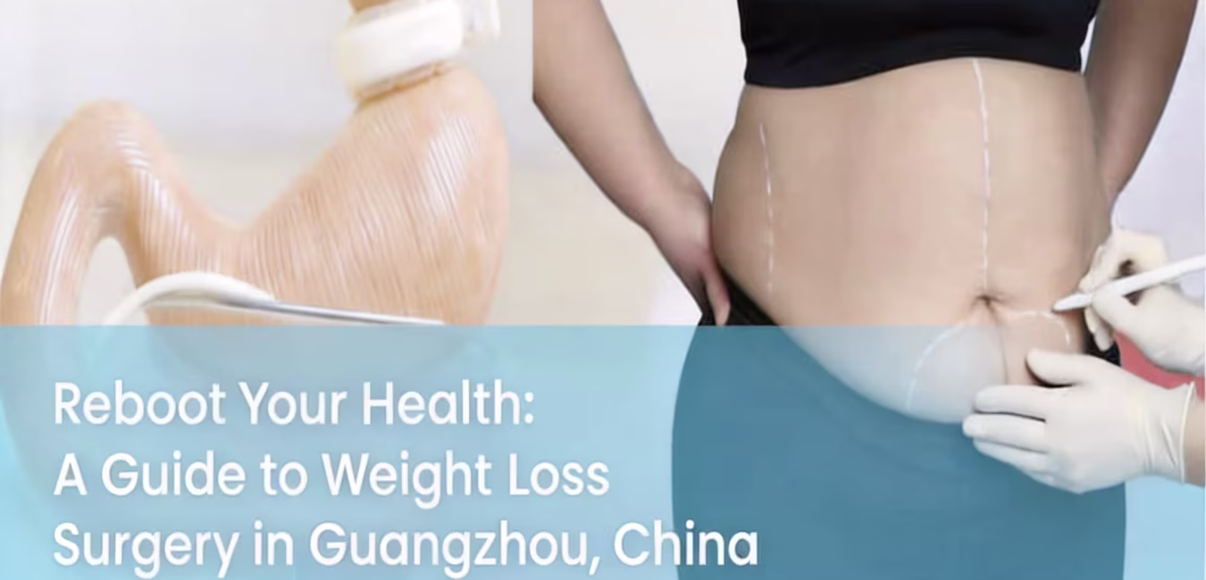 Weight Loss Surgery in Guangzhou